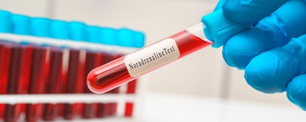 Noradrenaline in a test tube in adrenal glands