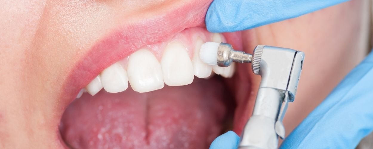 Dentist who whitens teeth